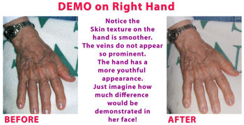 Hand Demo. Click for larger image